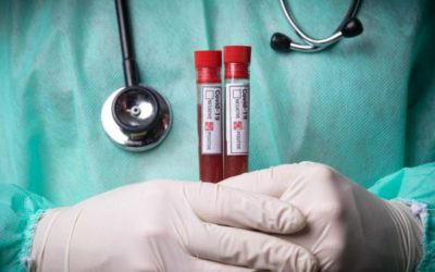 Manje hospitaliziranih, ali 155 novopozitivnih i sedam preminulih