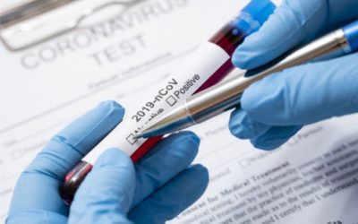 U OBŽ na koronavirus novopozitivno 242 osobe, 10 osoba preminulo